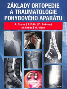 Základy ortopedie a traumatologie pohybového aparátu