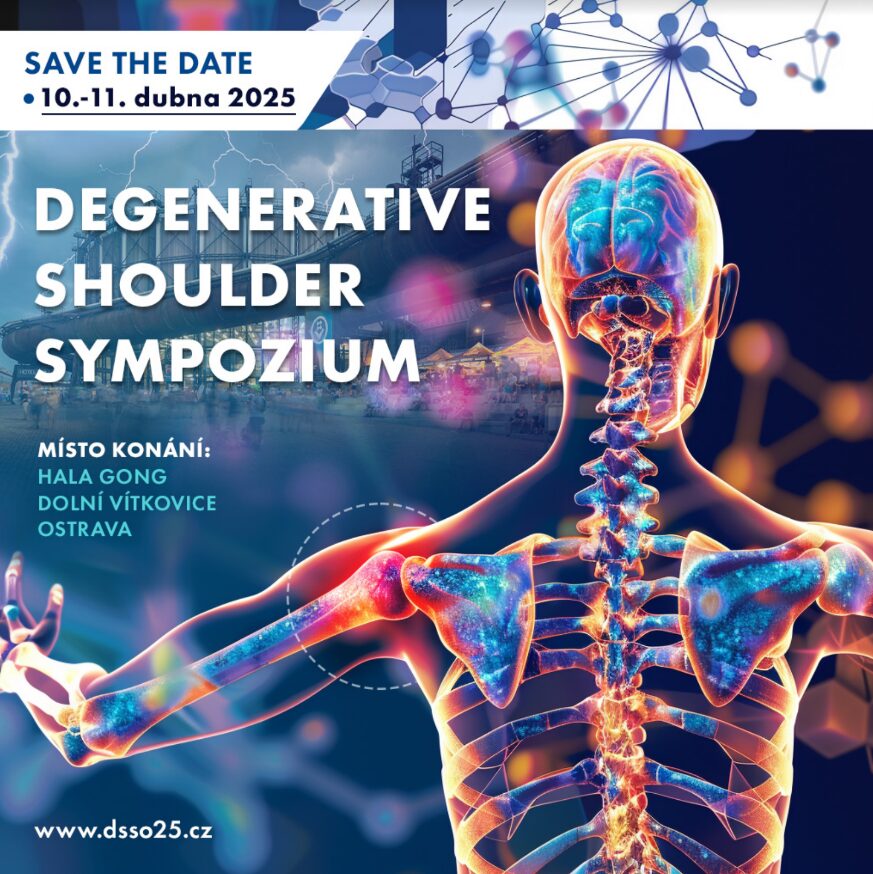 Přečtete si více ze článku Degenerative shoulder sympozium, 10.-11.4.2025, Ostrava